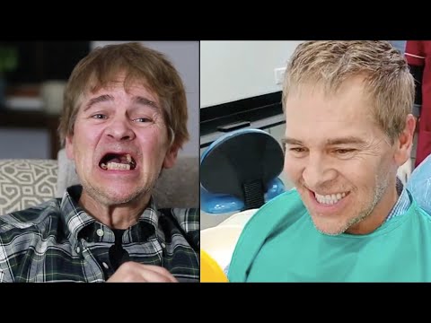 3 Day Dental Implants - Permanent Teeth (not dentures)