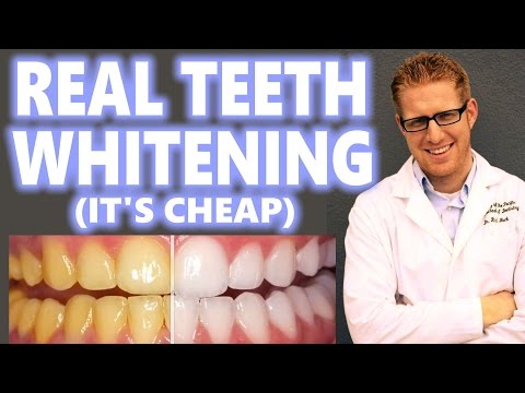 Teeth Whitening at Home Cheap How to Peroxide Hacks DIY Bleach Trays Kit Best 2016 Overnight Results