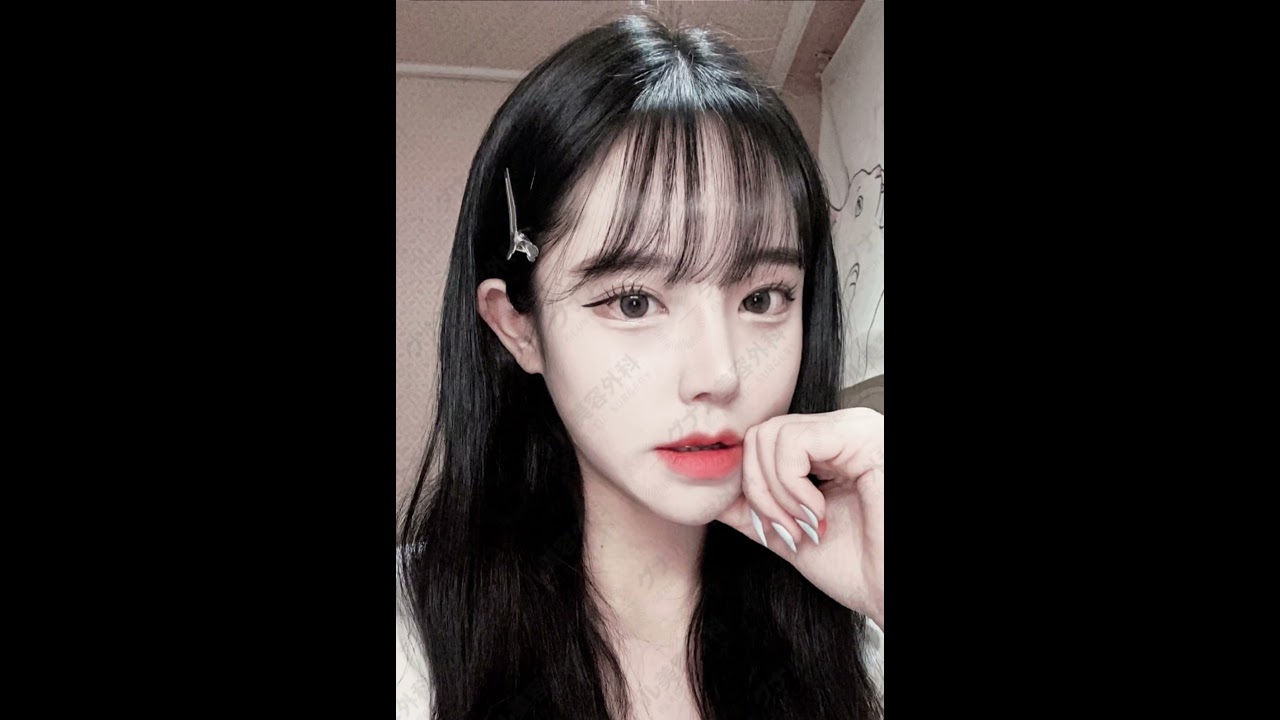 顔のバランスをさりげなく調整  #美容 #整形  #美容整形