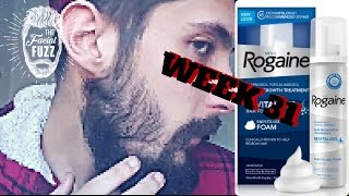 Minoxidil Beard | Week 31 | 7 MONTHS!!! | The Experiment | #Facialfuzzfridays