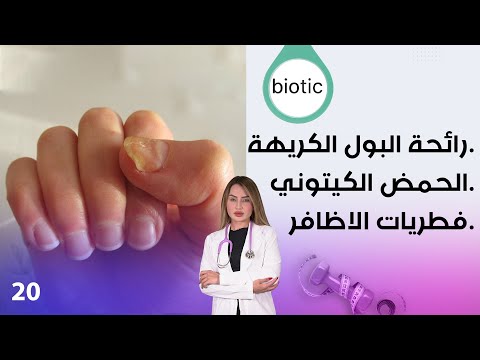 شاهد بالفيديو.. ‏ الحمض الكيتوني ، رائحة البول الكريهة وفطريات الاظافر - م٣ Biotic - الحلقة ٢٠