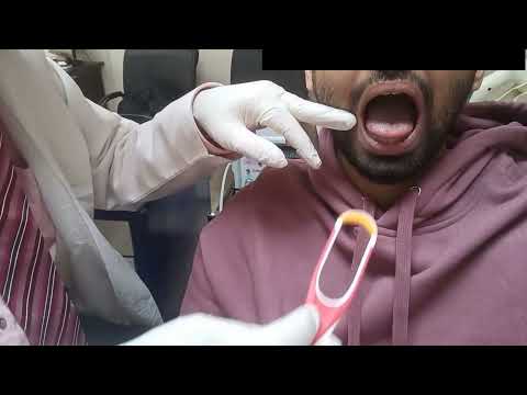 Ağız Kokusu Videosu Küçük Görseli