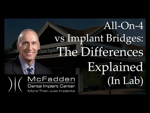 All-On-4 vs. Implant Bridges Explained In The Lab