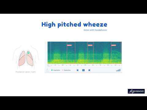 Lung sounds - High pitched wheeze