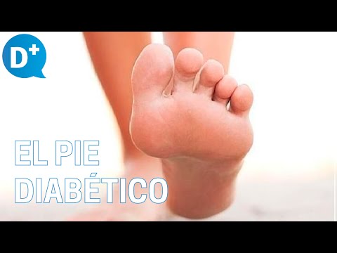 ¿Qué es el pie diabético?