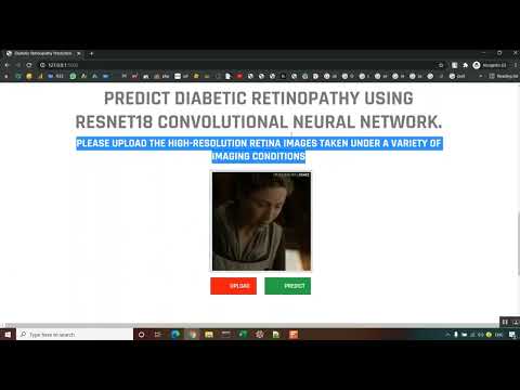 Diabetic Retinopathy Inception in Python Projects