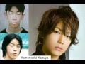 KAT-TUN plastic surgery 