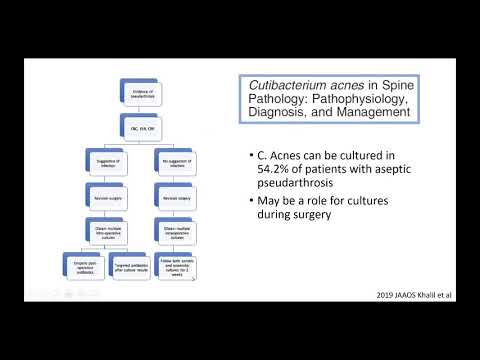 Pseudarthrosis: Risks, Work-Up, and Management - March 8, 2021 Lecture Mimi Peterson, MD