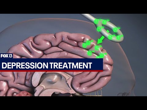 Depression treatment using magnetic stimulation