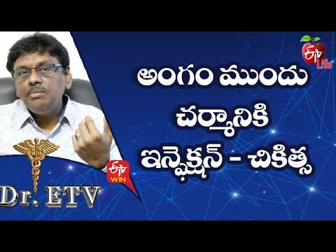 Balanitis - Treatment | Dr.ETV | 29th January 2022  | ETV Life