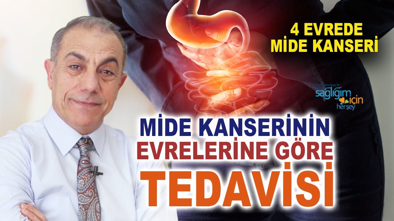 Mide Kanserinin Evrelerine Göre Tedavisi