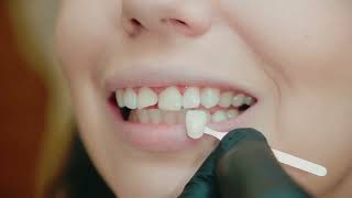 Vídeo de Rayshape Edge Mini a Impressora 3D para Odontologia