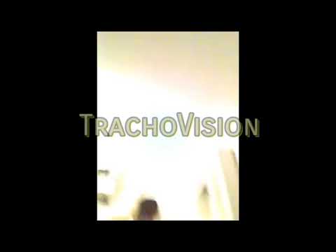 FSK/freestyle di Younggucci (sebez) con sapone pomata e phago