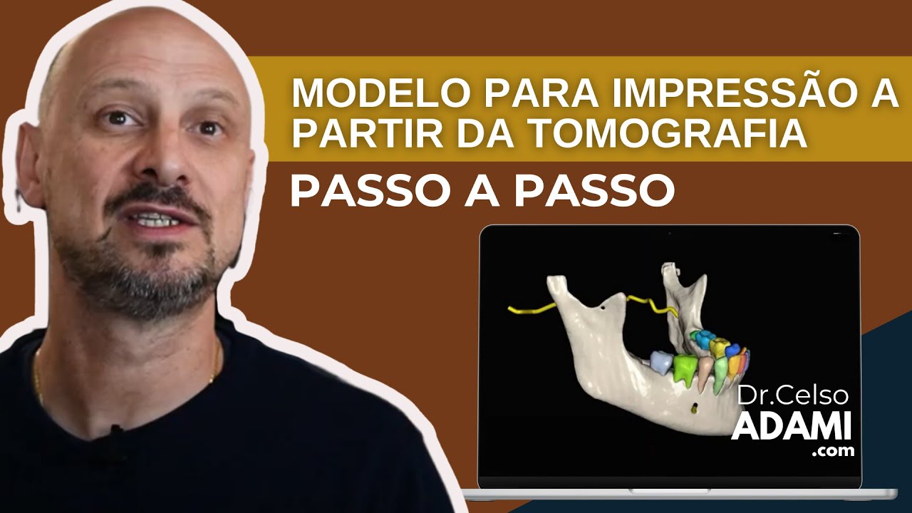 COMO CRIAR MODELOS 3D A PARTIR DE UMA TOMOGRAFIA UTILIZANDO O BLUESKY PLAN E O MESHMIXER