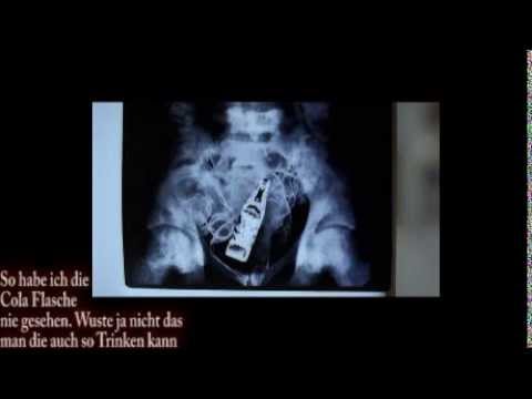 Laser-Behandlung von Hernien der Halswirbelsäule Ð »ÐμÑ ‡ ÐμниÐμ мÐμÐикРdie мÐμнÑ, оР· ноÐμ Ð¾Ñ Ñ, ÐμÐ¾Ñ ... онÐÑ € оР· ов