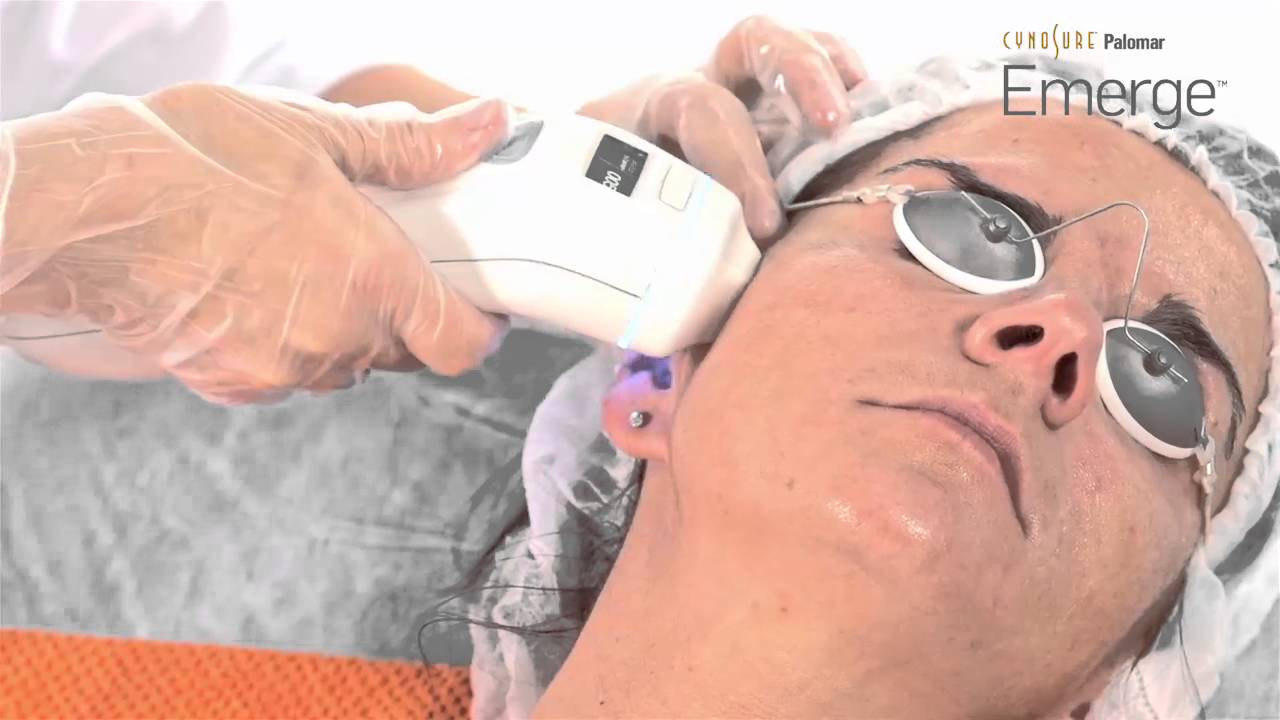 Watch Emerge, láser fraccional no ablativo Now Emerge, láser fraccional no ablativo