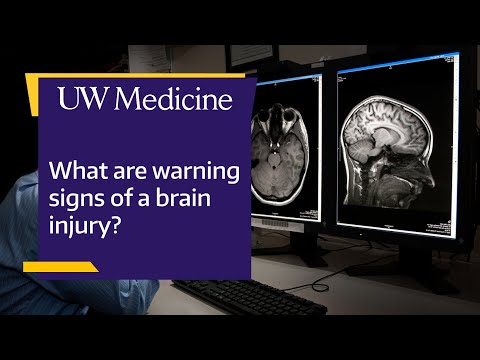 Seemingly minor head injuries can turn critical