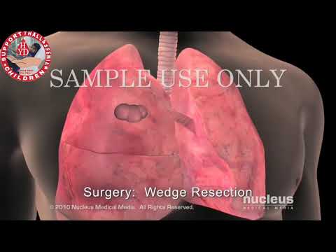 S T C & S H HYD 0333 2533058  0317 3008361