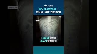 부모님 무서워서...중국서 수은 온도계 삼키고 20년 방치한 남성 #JTBC #Shorts