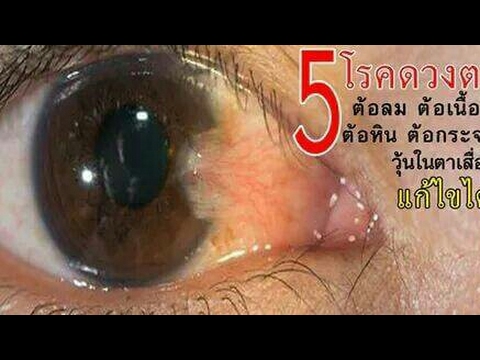การโฆษณาสำหรับสายไฟแรง ธ อร์ราคาลดลงค้อน