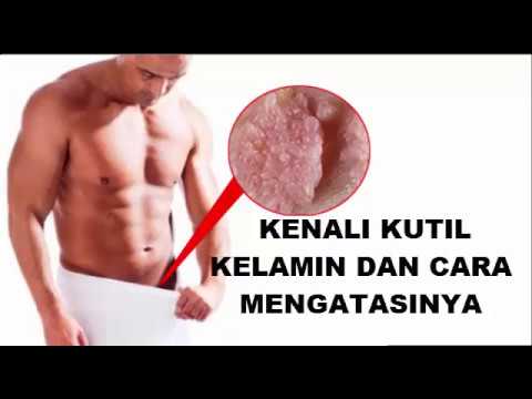 Latihan untuk potensi laki-laki Dampak pada potensi goji berry