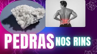 Como acabar com as PEDRAS NOS RINS definitivamente. como tratar, tipos , causas . saiba tudo.