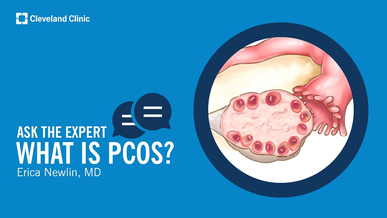 What Is Polycystic Ovary Syndrome? | Ask Cleveland Clinic’s Expert