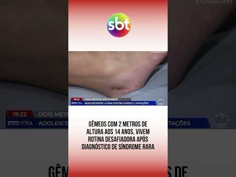 Twins, 2 meters tall at 14, face challenging routine after diagnosis of rare syndrome