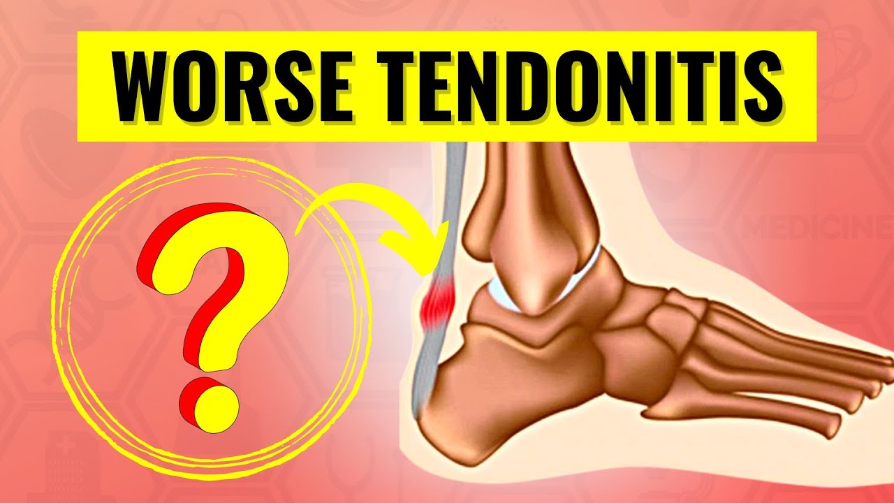 The Truth About Tendonitis: Why It's Not Just Inflammation and How to Treat It