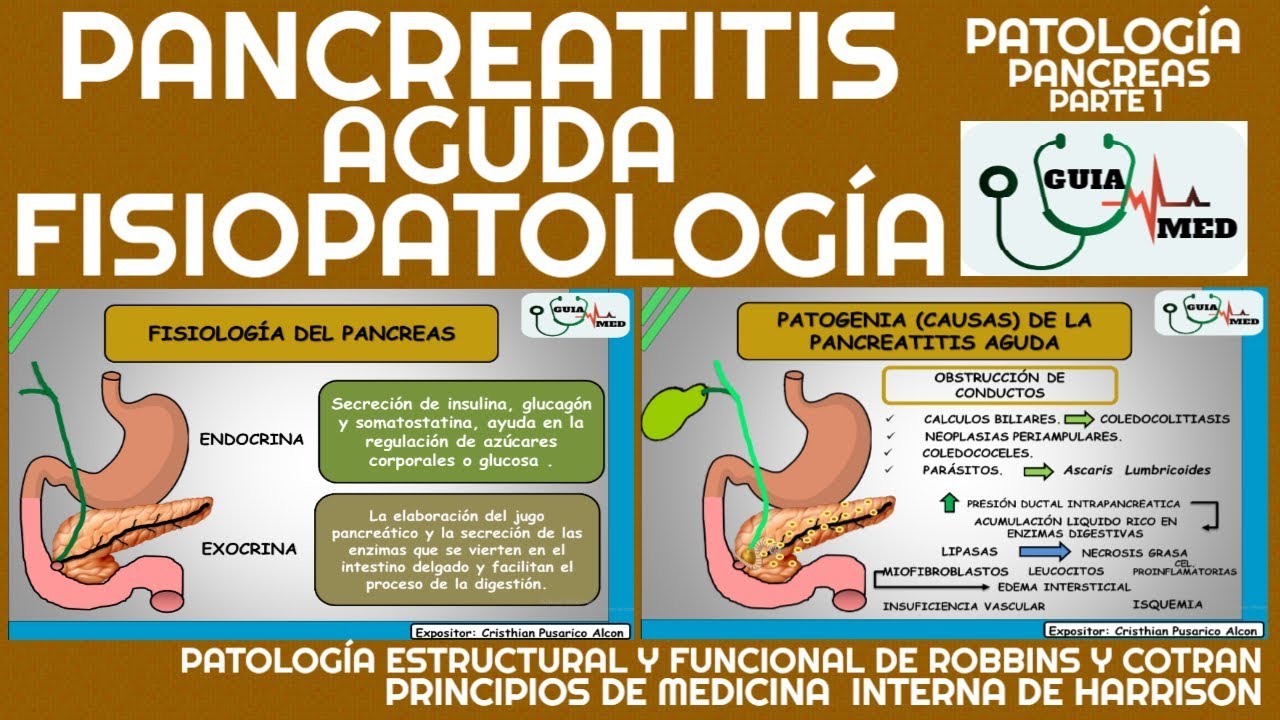 PANCREATITIS AGUDA FISIOPATOLOGÍA | GuiaMed