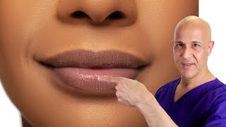 How to Plump Your Lips Naturally!  Dr. Mandell