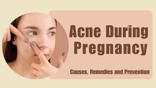 Acne During Pregnancy | How To Get Rid Of Pregnancy Acne Fast | Pregnancy Skin Care