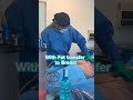 Lipo 360º Fat Transfer To Breast By Dr Bucio Plasticsurgery Lipo360 Tijuana Sandiego Lipo