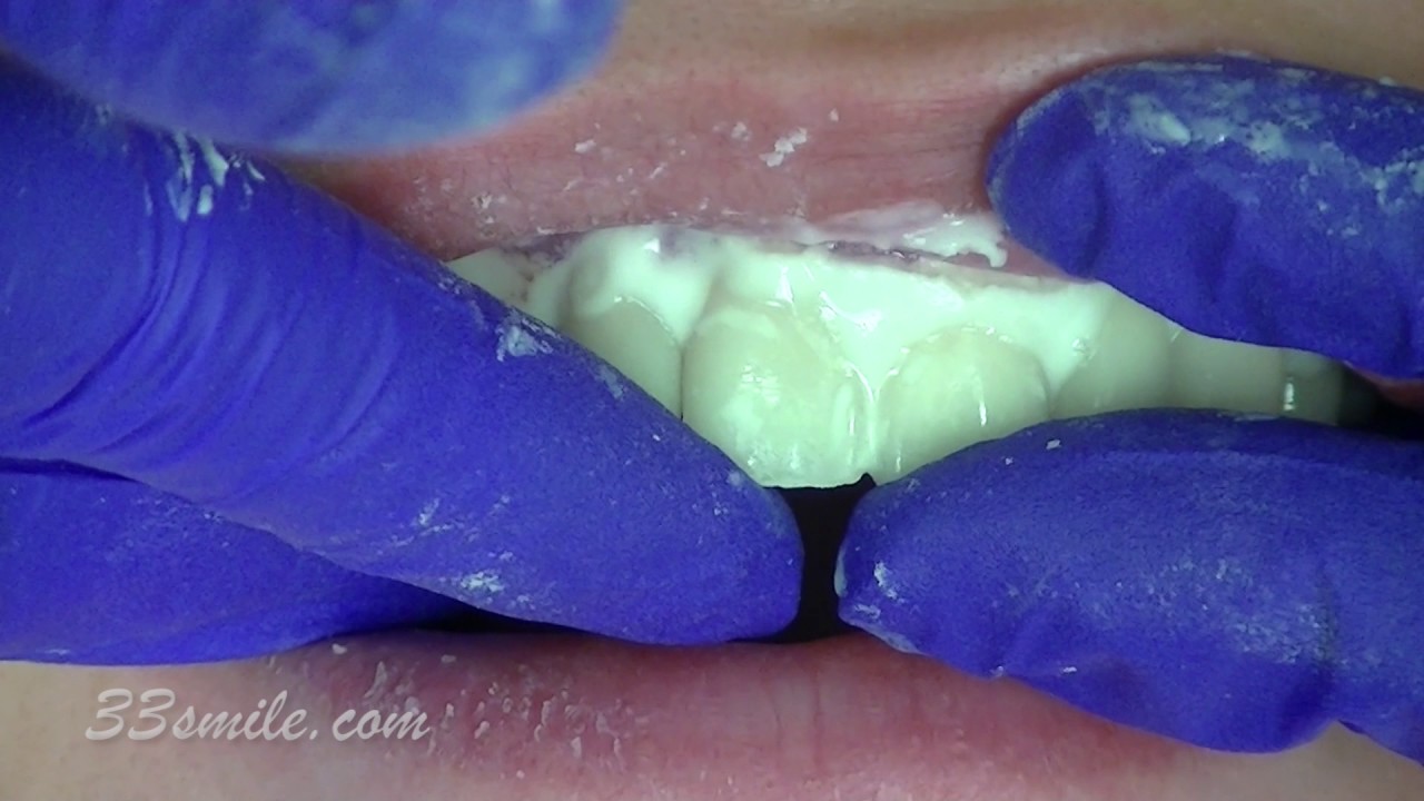 Dentist San Antonio, TX Cosmetic Dental Associates