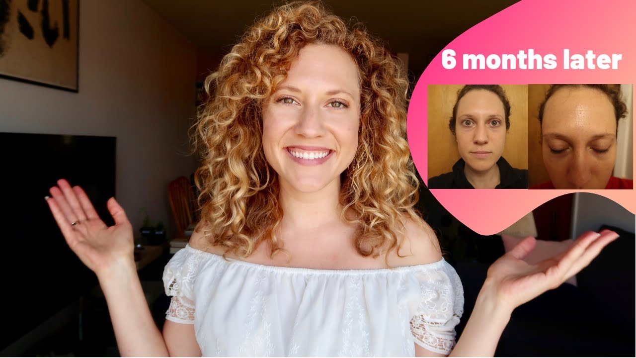 I stopped taking collagen!!! + before and after pics