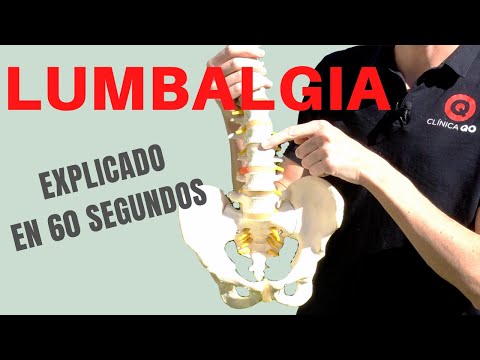 LUMBALGIA (Explicado en 60 Segundos)