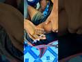 Doctor Injection Short Video Music Song Newsong Doctor Rap Hilight