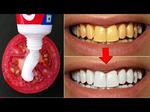paraziták amelyek petét raknak a bőr alá pinworms és duodenitis