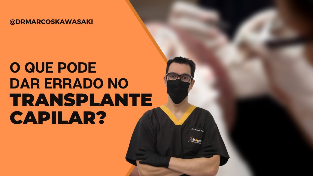 O que pode dar errado no transplante capilar?