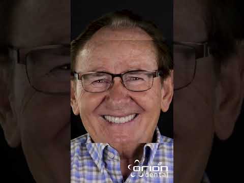 ORION DENTAL EXPERIENCE | #SHORT