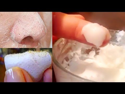 Posti di pigmentary di vitiligo di una fotografia Guardi fanno i bagagli pigmentary nota il carbonato di sodio