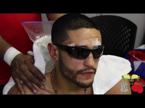 Miguel Cruz is a warrior and has the scars to prove it