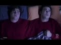 Funny Siamese Twins