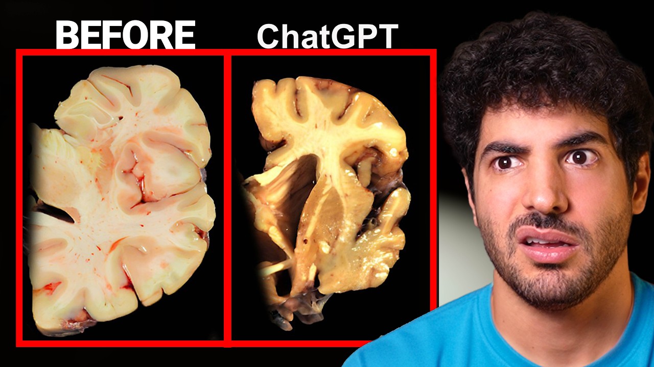 It's Official: ChatGPT is Making You Dumb