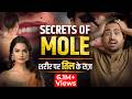 What Do Moles On Body Parts Indicate Moles On Body Reveal About Your Behavior Astro Arun Pandit