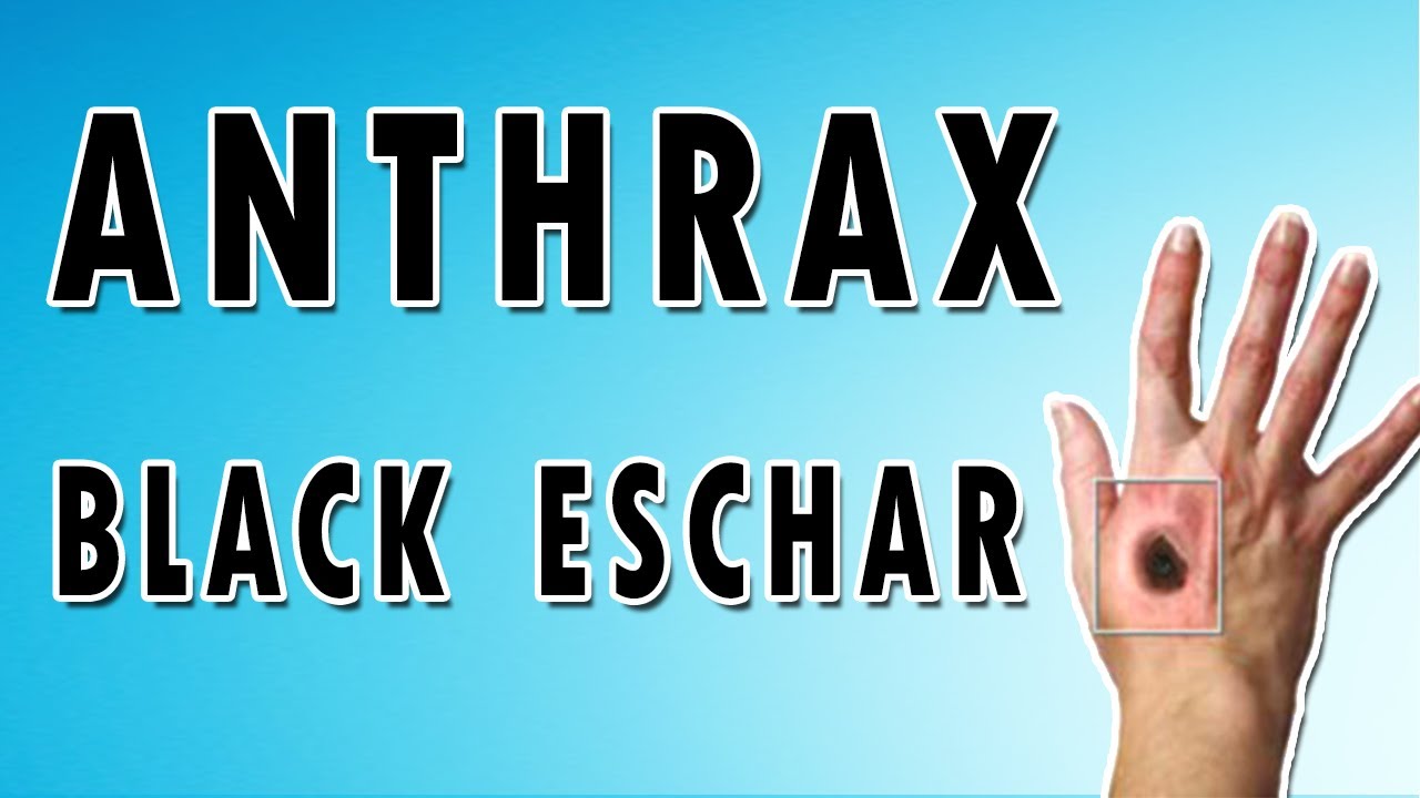 What precautions are used for anthrax?