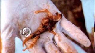 Pro Life Youth Alliance slideshow