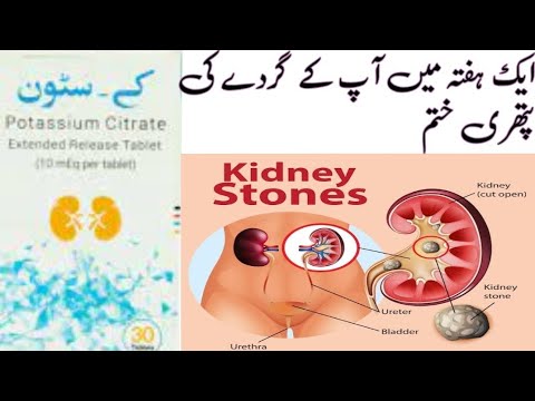 k. stone medicine use for kidney stones, || K stone medicine,potassium citrate,