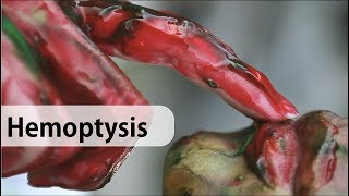 Hemoptysis: causes, diagnosis and management
