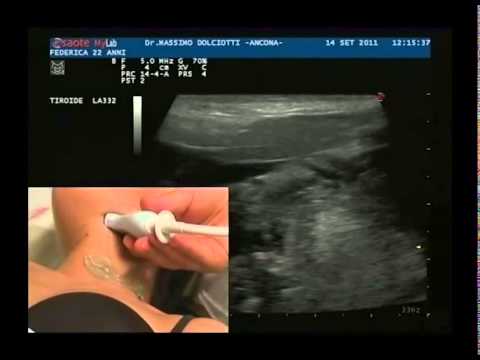 Cane pastore tedesco con displasia dellanca Un dolore sordo nel cuore e back to back